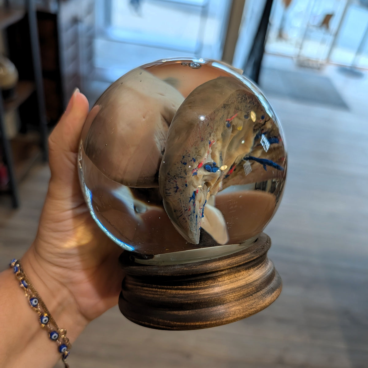 Bisected Pig Kidney Globe