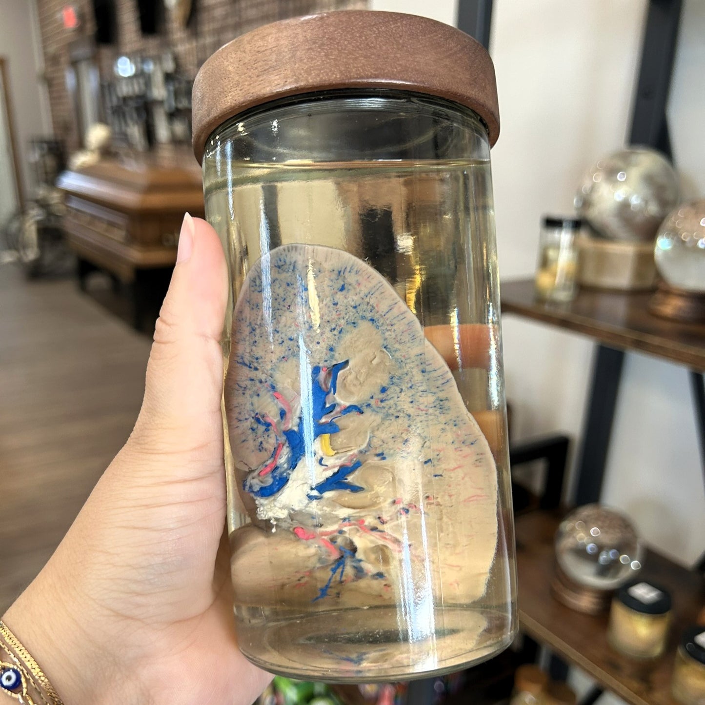 Bisected Pig Kidney Jar
