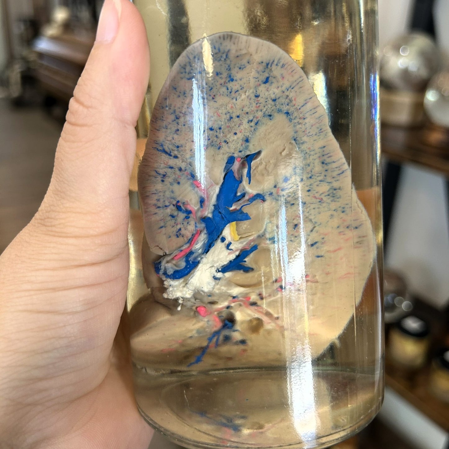 Bisected Pig Kidney Jar