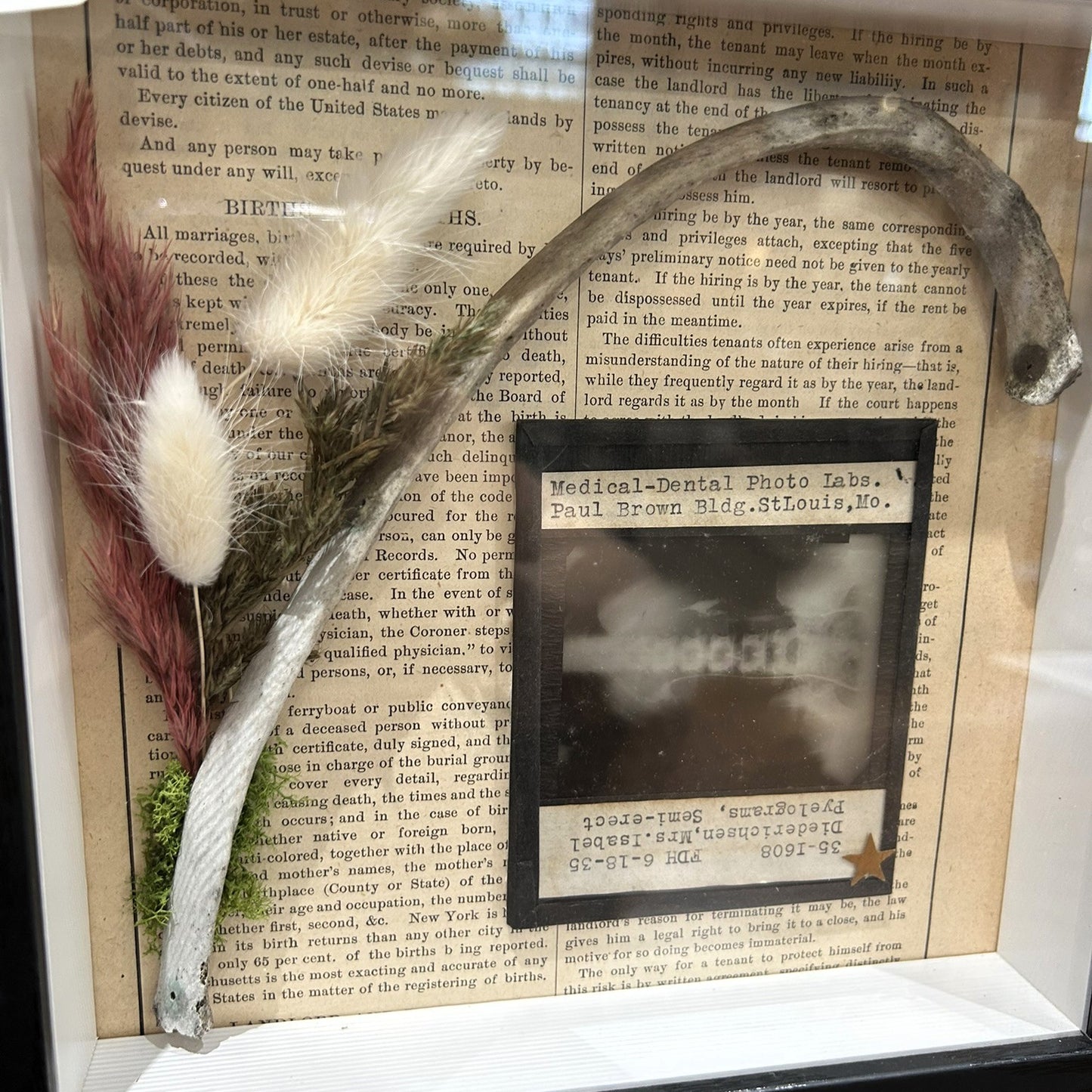 Human Rib with Glass Negative