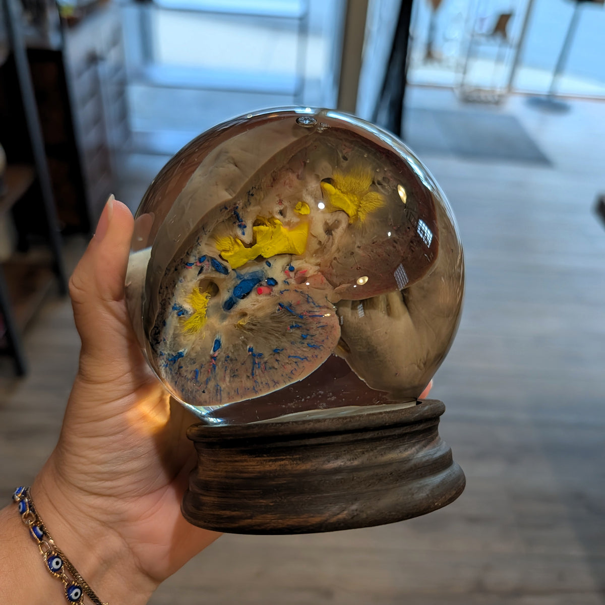 Bisected Pig Kidney Globe